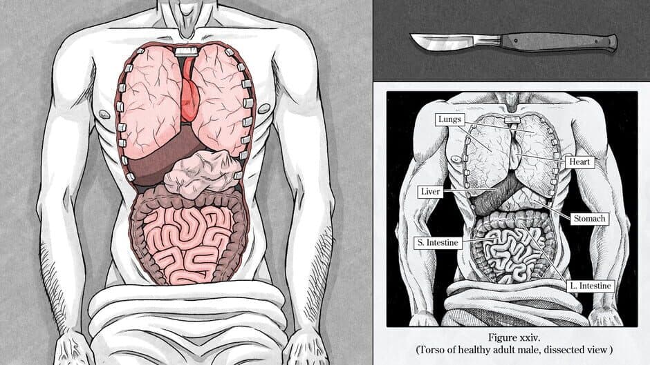Edwin Earstwhile: Medical Examiner screenshot 3